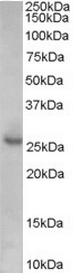 p27 Kip1 Antibody in Western Blot (WB)