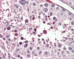 PIAS2 Antibody in Immunohistochemistry (Paraffin) (IHC (P))