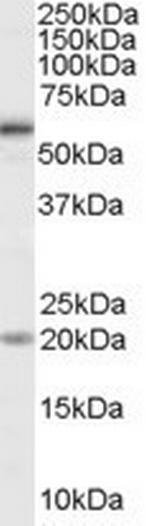 BMPR1A Antibody in Western Blot (WB)