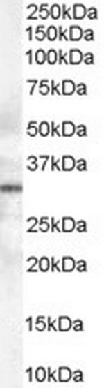 Syntaxin 6 Antibody in Western Blot (WB)