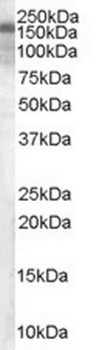 TSC1 Antibody in Western Blot (WB)