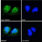 CK1 delta Antibody in Immunocytochemistry (ICC/IF)