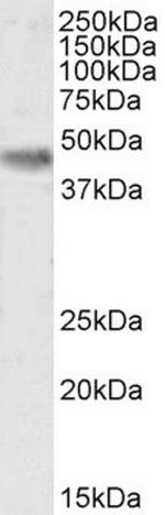 CK1 delta Antibody in Western Blot (WB)