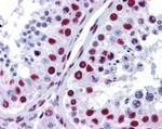 NONO Antibody in Immunohistochemistry (Paraffin) (IHC (P))