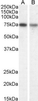 ChAT Antibody in Western Blot (WB)