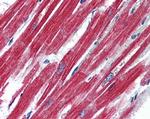 Leptin Receptor Antibody in Immunohistochemistry (Paraffin) (IHC (P))