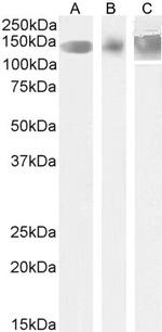 Leptin Receptor Antibody in Western Blot (WB)