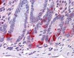 Chromogranin A Precursor Antibody in Immunohistochemistry (Paraffin) (IHC (P))