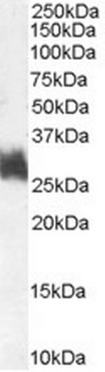 Fra1 Antibody in Western Blot (WB)