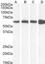 Catalase Antibody in Western Blot (WB)