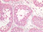 HSC70 Antibody in Immunohistochemistry (Paraffin) (IHC (P))