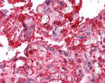 Radixin Antibody in Immunohistochemistry (Paraffin) (IHC (P))