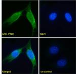 PTCH Antibody in Immunocytochemistry (ICC/IF)