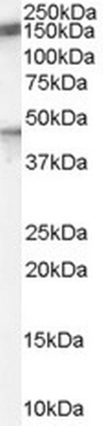 PTCH Antibody in Western Blot (WB)