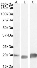 GPX4 Antibody in Western Blot (WB)