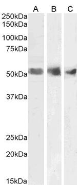 WT1 Antibody in Western Blot (WB)