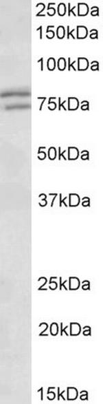 FXR1 Antibody in Western Blot (WB)