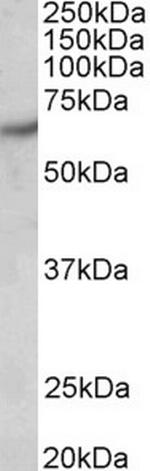 PAK1 Antibody in Western Blot (WB)