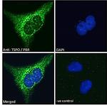 TSPO Antibody in Immunocytochemistry (ICC/IF)