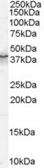 QKI Antibody in Western Blot (WB)