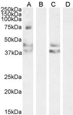 AGTR1 Antibody in Western Blot (WB)