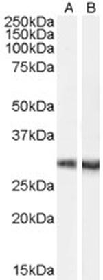 DCDC2 Antibody in Western Blot (WB)