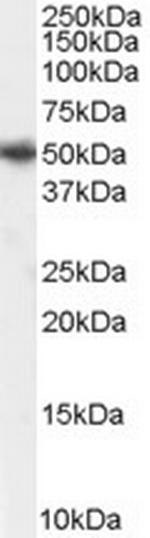 PICK1 Antibody in Western Blot (WB)