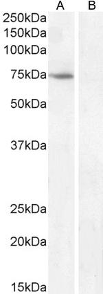 FEZ1 Antibody in Western Blot (WB)