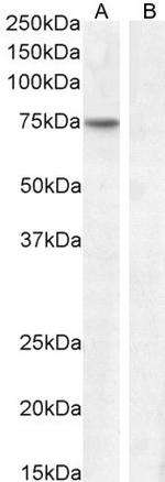 FEZ1 Antibody in Western Blot (WB)