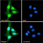 PRPF31 Antibody in Immunocytochemistry (ICC/IF)