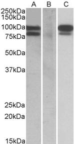 PCSK9 Antibody in Western Blot (WB)