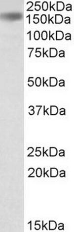 Drosha Antibody in Western Blot (WB)