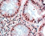 MBD2 Antibody in Immunohistochemistry (Paraffin) (IHC (P))