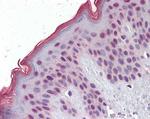 MBD2 Antibody in Immunohistochemistry (Paraffin) (IHC (P))