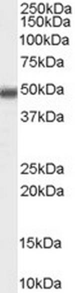 MBD2 Antibody in Western Blot (WB)