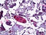 DGAT1 Antibody in Immunohistochemistry (Paraffin) (IHC (P))