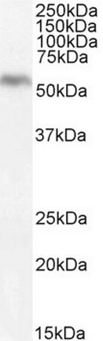 DGAT1 Antibody in Western Blot (WB)