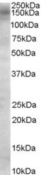 AS160 Antibody in Western Blot (WB)