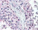 GPSM2 Antibody in Immunohistochemistry (Paraffin) (IHC (P))