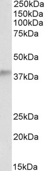 ADH5 Antibody in Western Blot (WB)