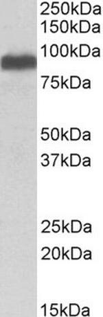 ITCH Antibody in Western Blot (WB)