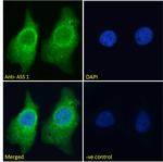 ASS1 Antibody in Immunocytochemistry (ICC/IF)