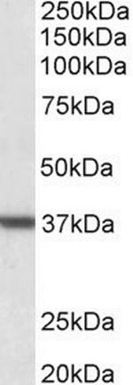 Arginase 1 Antibody in Western Blot (WB)