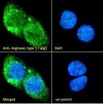 Arginase 1 Antibody in Immunocytochemistry (ICC/IF)