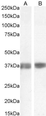 Arginase 1 Antibody in Western Blot (WB)