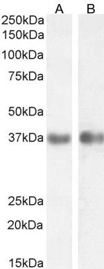 Arginase 1 Antibody in Western Blot (WB)