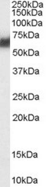 PDIA2 Antibody in Western Blot (WB)