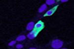 CLIC4 Antibody in Immunocytochemistry (ICC/IF)