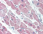 CLIC4 Antibody in Immunohistochemistry (Paraffin) (IHC (P))