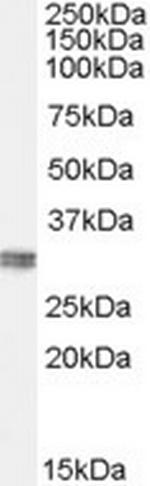 CLIC4 Antibody in Western Blot (WB)